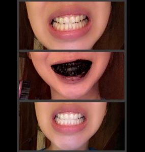 effets et résultats de denta black